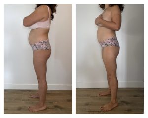 Renata França /Drainage Lymphatique/Remodelage Renata França /Maderotherapie / Miracle face /Massage Anti Ride Visage Kobido