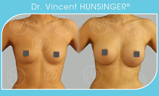 Dr Vincent Hunsinger - Chirurgien plastique et esthétique