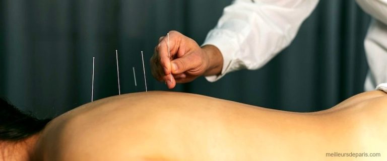 Les 10 meilleures cliniques dacupuncture à Paris